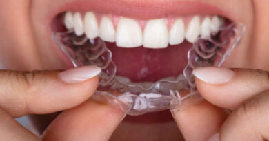 Are Invisalign Worth the Cost? Are Invisalign Worth the Cost?